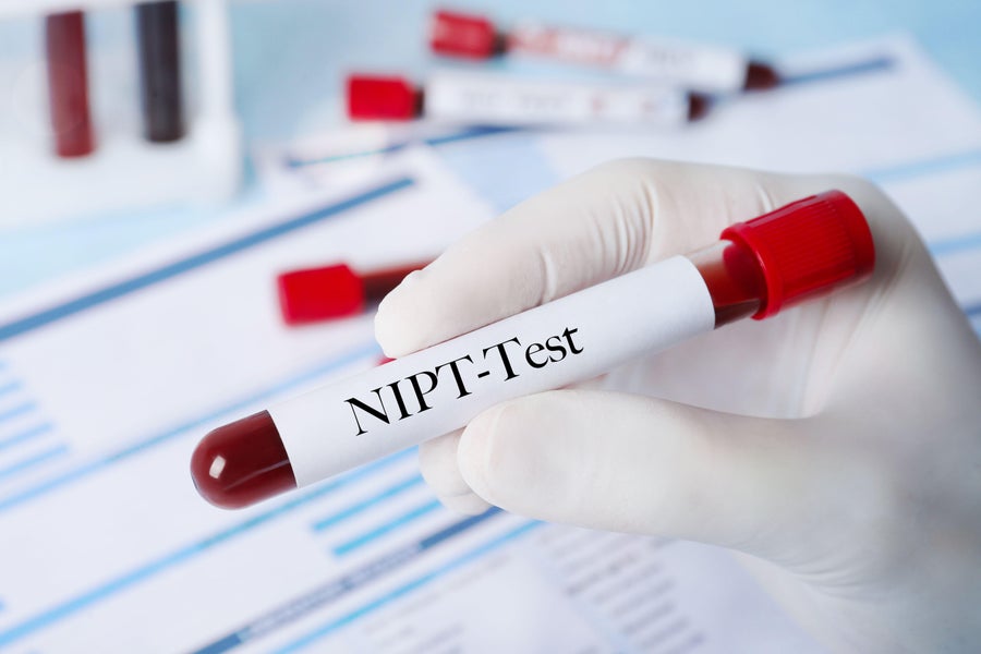 https://static.scientificamerican.com/dam/m/6b4dcfcb162b1fbf/original/Noninvasive_prenatal_testing-NIPT.jpg?m=1742824985.079&w=900