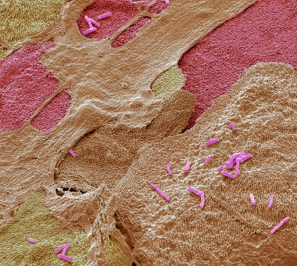 Colored scanning electron micrograph (SEM) of Escherichia coli (E. coli)