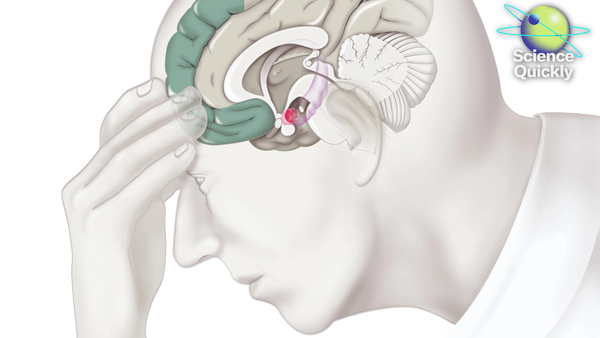 An illustration of a man holding his head with a digram of his brain showing.