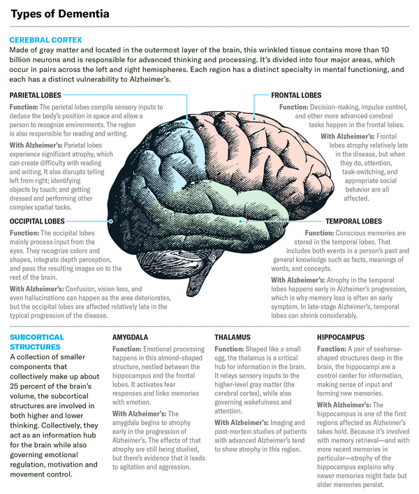 Alzheimer’s Impact on the Brain | Scientific American