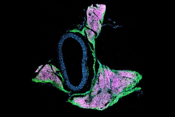 A mouse aorta with immunofluorescent tagging.