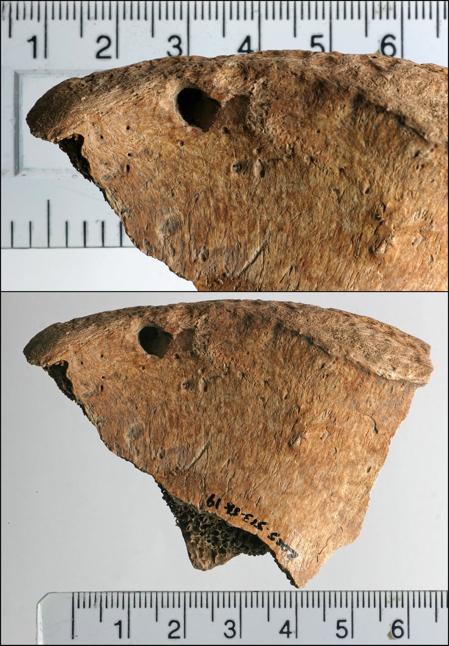Photo figure from study showing lesions on the left iliac spine of 6DT19