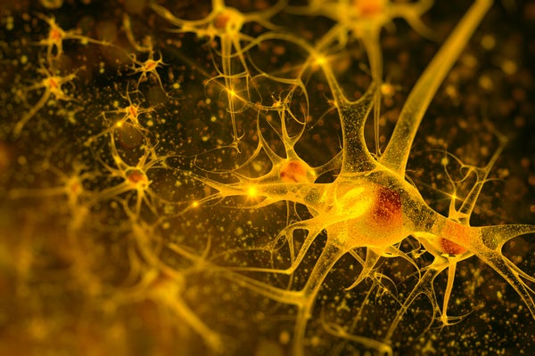 digital illustration of yellow neurons