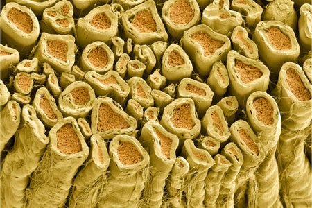 Micrograph of myelinated axons in a rat vertebral root. Myelin forms a sheath around the axon, shown in yellow.