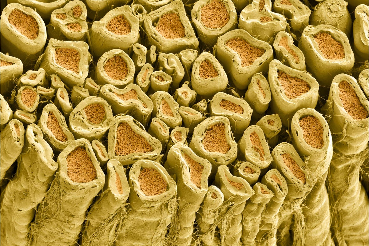 Micrograph of myelinated axons in a rat vertebral root. Myelin forms a sheath around the axon, shown in yellow. 