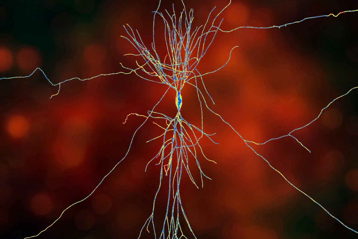 Hippocampus neuron spider on orange.