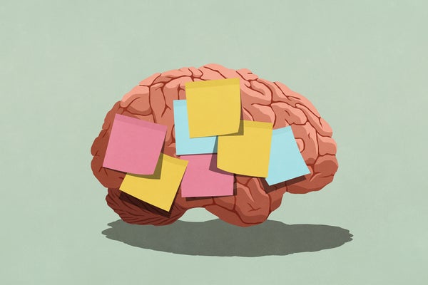 Digital illustration, adhesive notes covering brain sitting on a green seamless surface and background