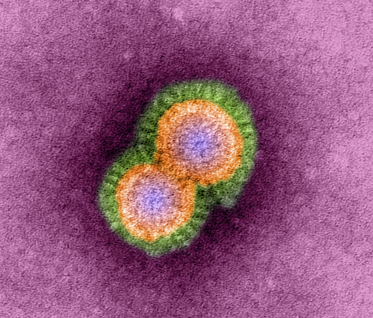 H5N1 avian influenza virus particles