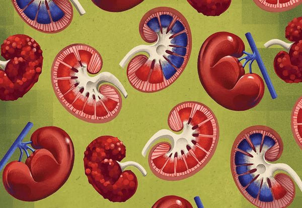Kidney disease "Innovations In" cover features a grid of kidneys.