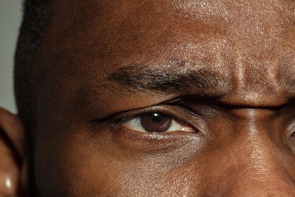 Close up of a man's eye with a slightly furrowed brow