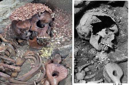 Side-by-side images of a skull and skeletal torso. The left image is in color and shows a cap on the skull made from small shells. The right image is black and white and shows a large hold in the skull