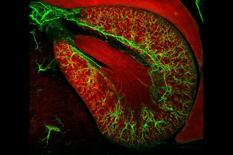 3D view of the sympathetic innervations to the kidney of a mouse