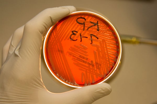 Gloved hand holding petri dish