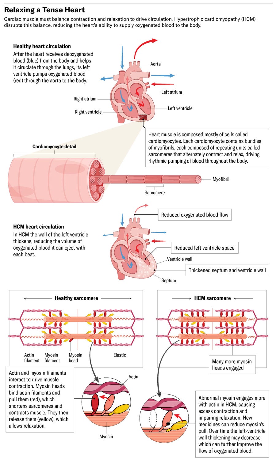 Cytokinetics Heart Muscle Illustration