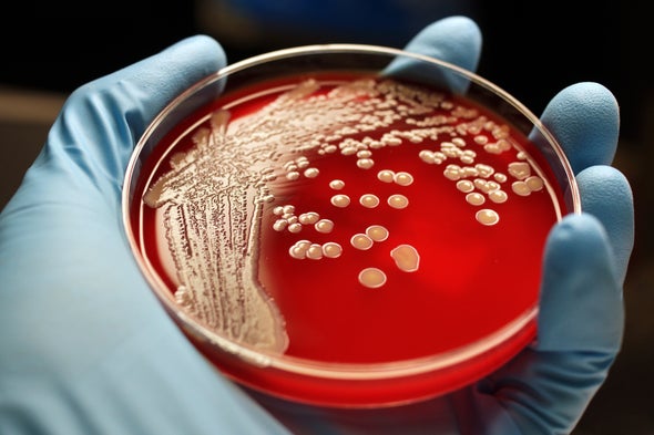 Naciones Unidas discutirá cómo frenar el auge de las superbacterias