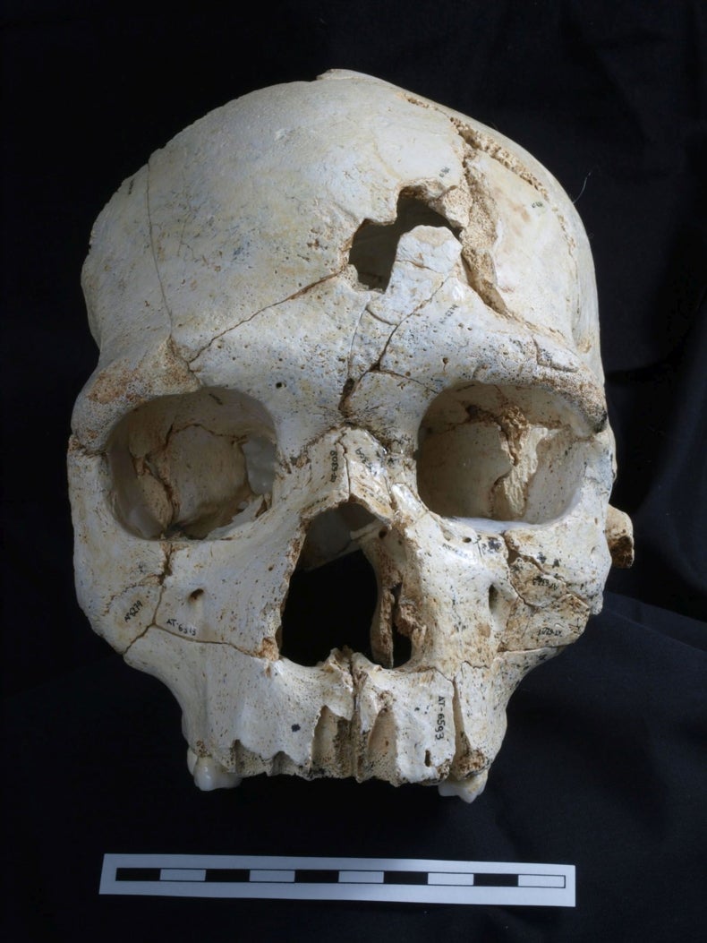 Lesiones en un cráneo resuelven homicidio de hace 430.000 años Noticias