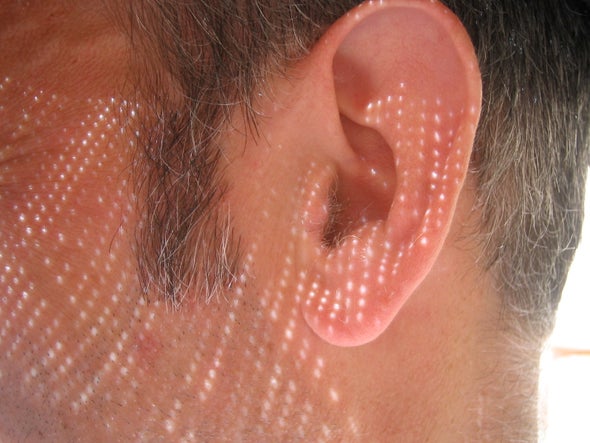 Con VIH, la disminución auditiva es más común