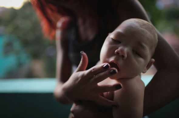 La variabilidad geográfica en los defectos de nacimiento causados por el zika confunde a los científicos
