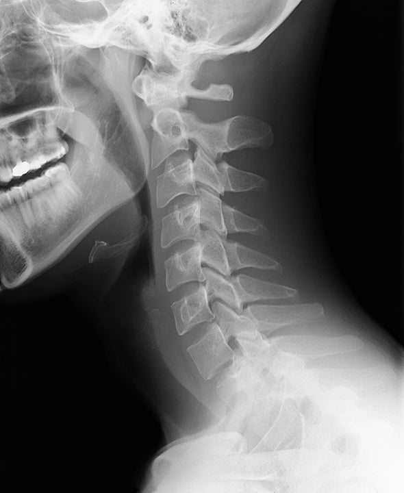 ¿Cómo se llama una radiografía de la cabeza? ¿Cómo se llama una radiografía de la cabeza?