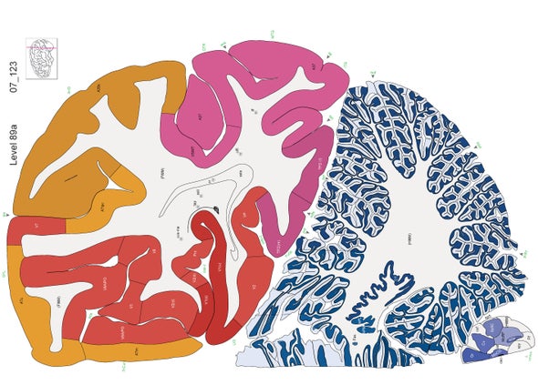 Mapa del cerebro humano recibe una audaz actualización