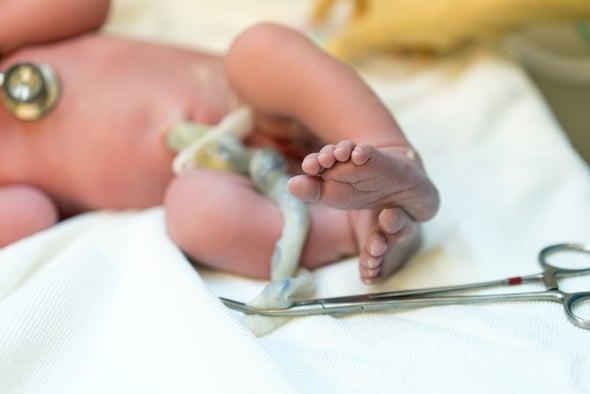 Demorar el bloqueo del cordón umbilical reduce el riesgo de anemia en los bebés