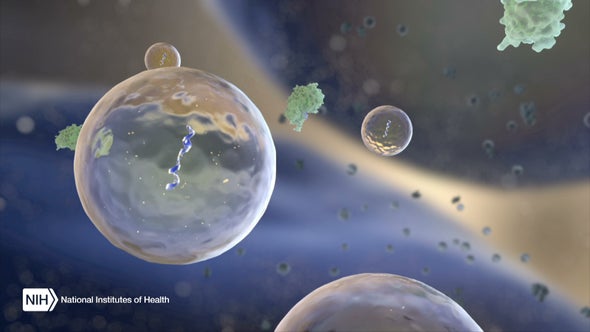 Exosomas: las bolsas de viaje del cáncer