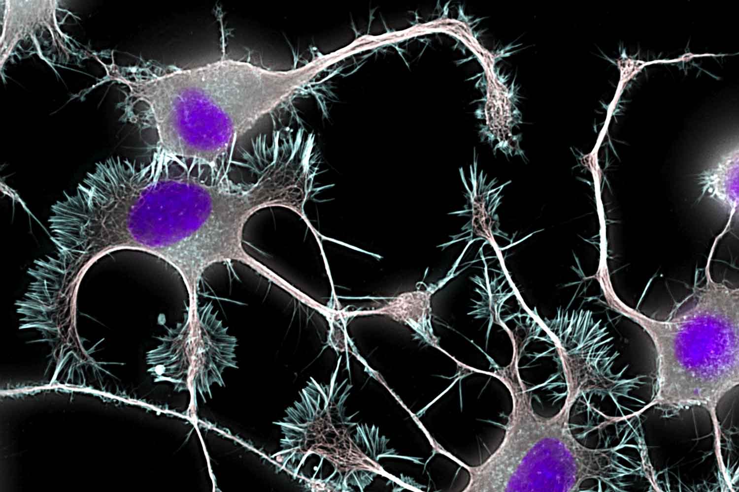 nerve cell growth