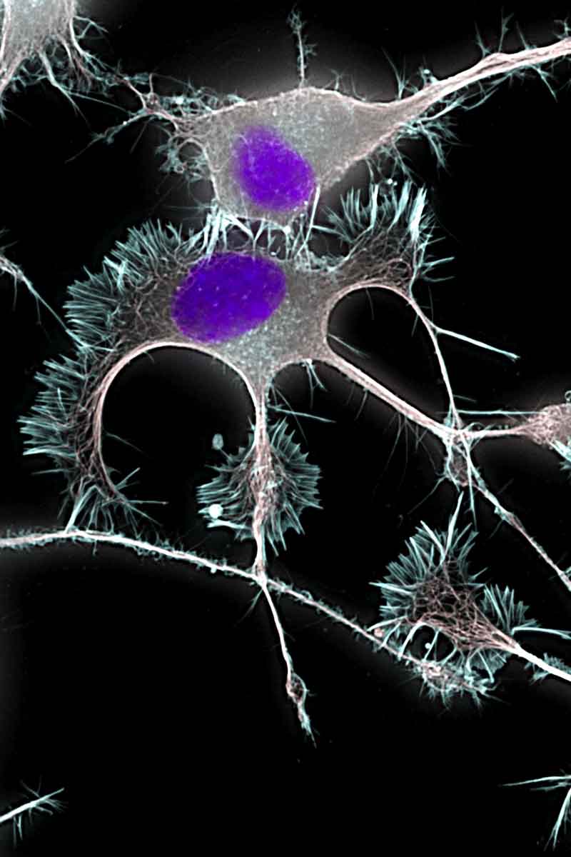 nerve cell growth