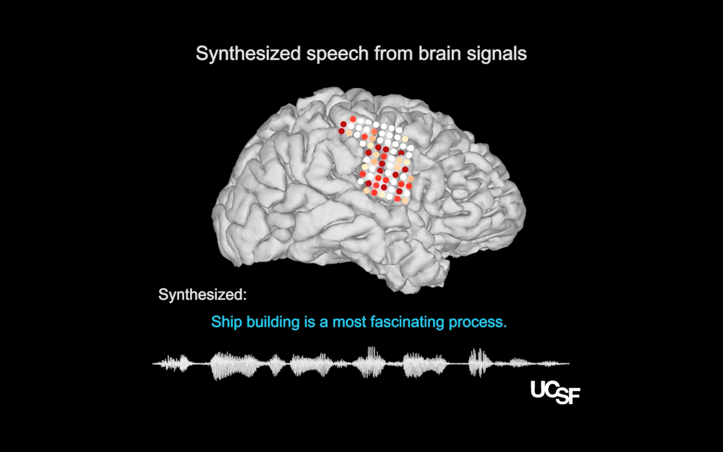 Scientists Take A Step Toward Decoding Speech From The Brain - 