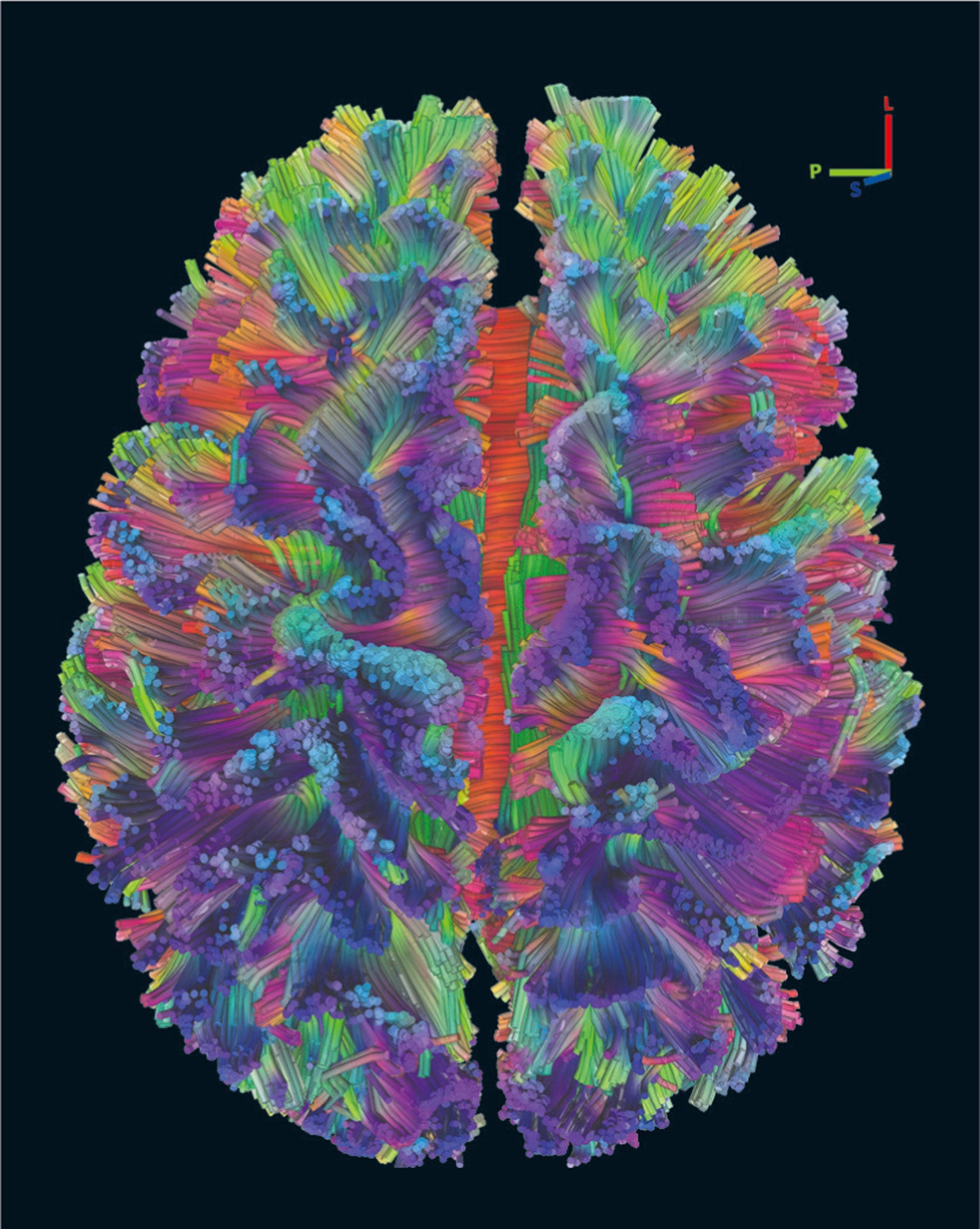 How the Mind Emerges from the Brain's Complex Networks