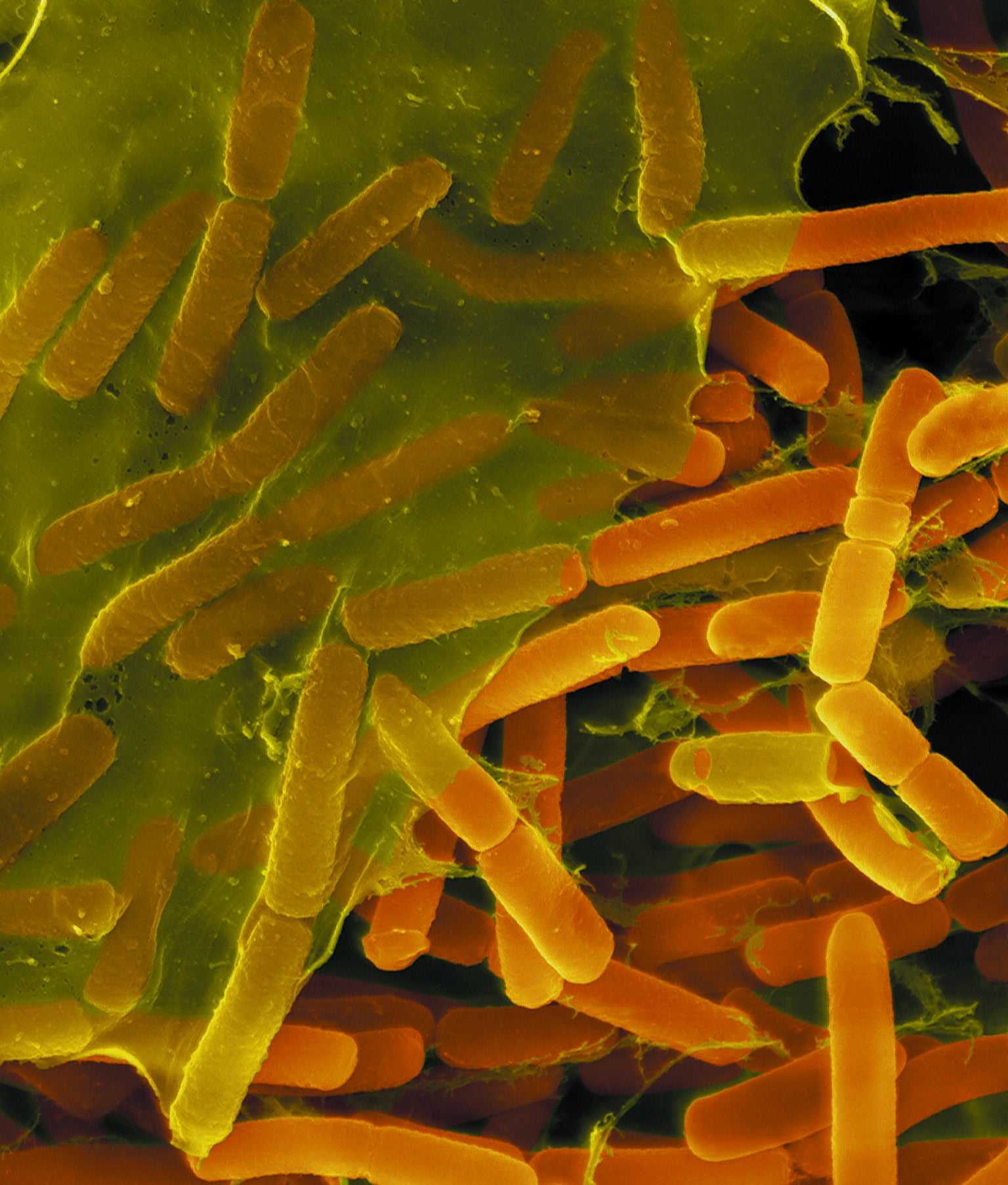 Bacteria Gang Together in Killer Biofilms, but Scientists Can Disrupt ...