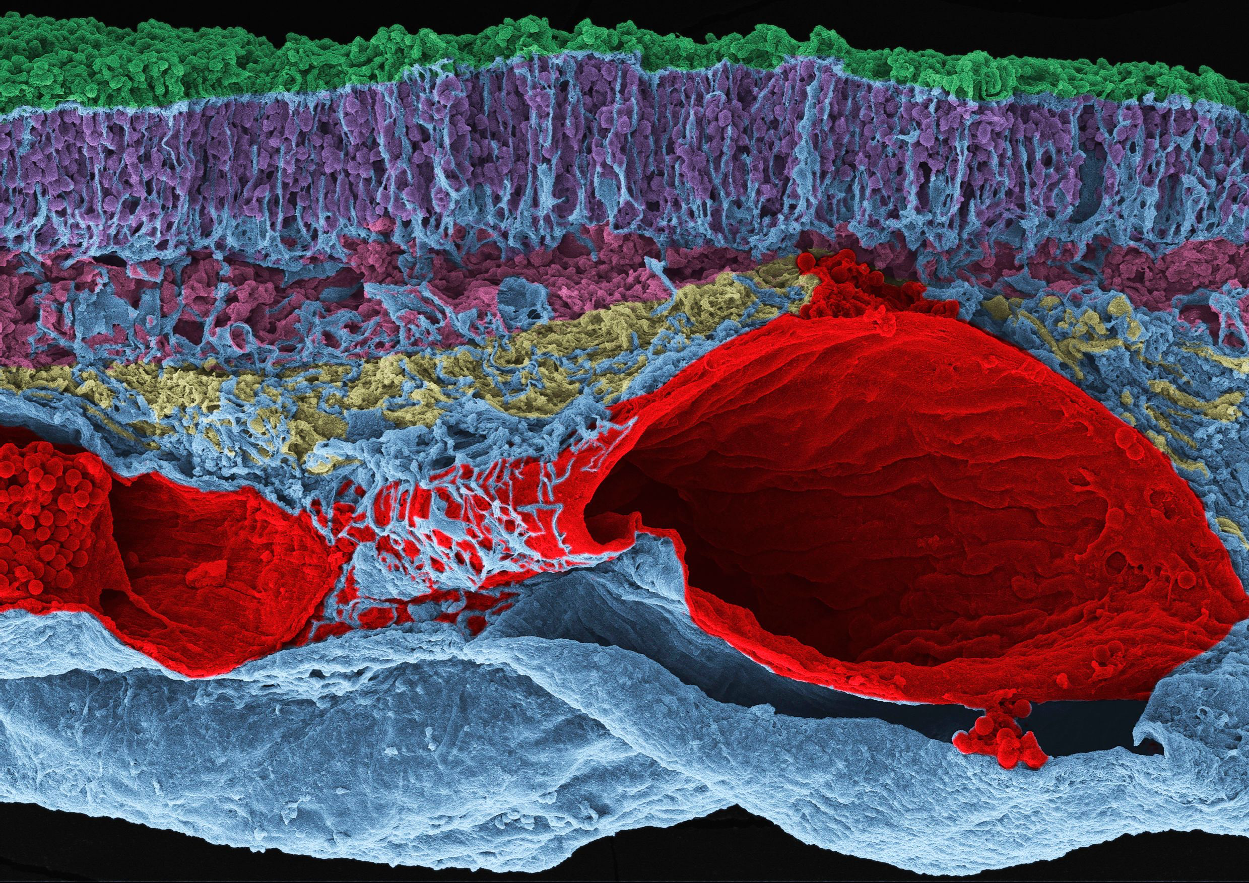 whale retina rainbow