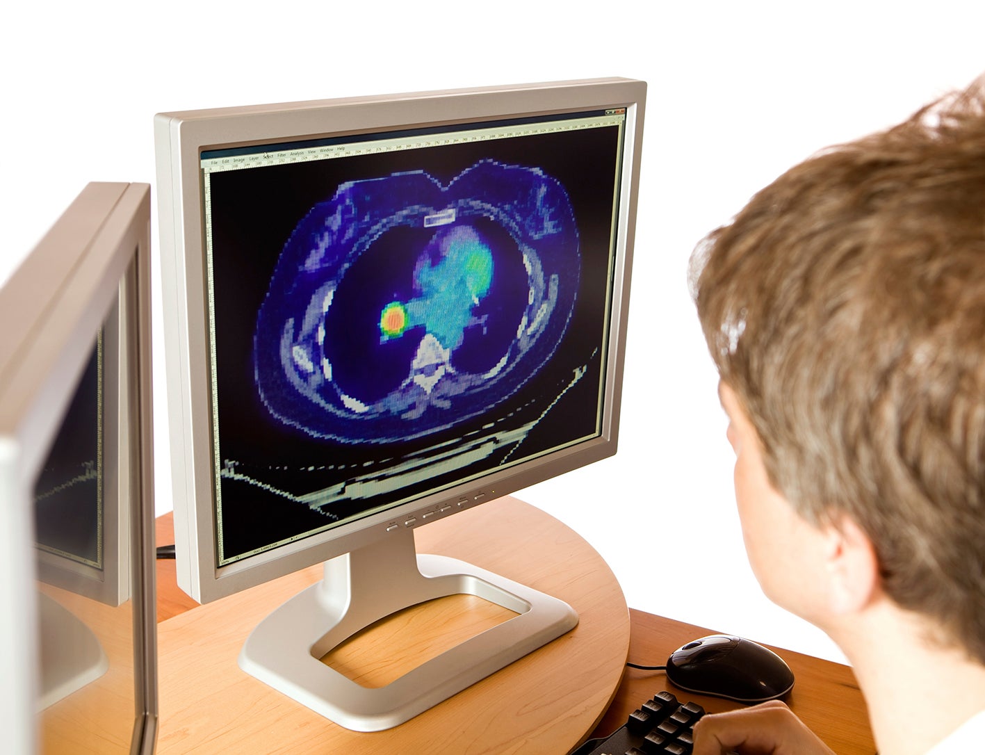 Man examining computed tomography in a computer screen.
