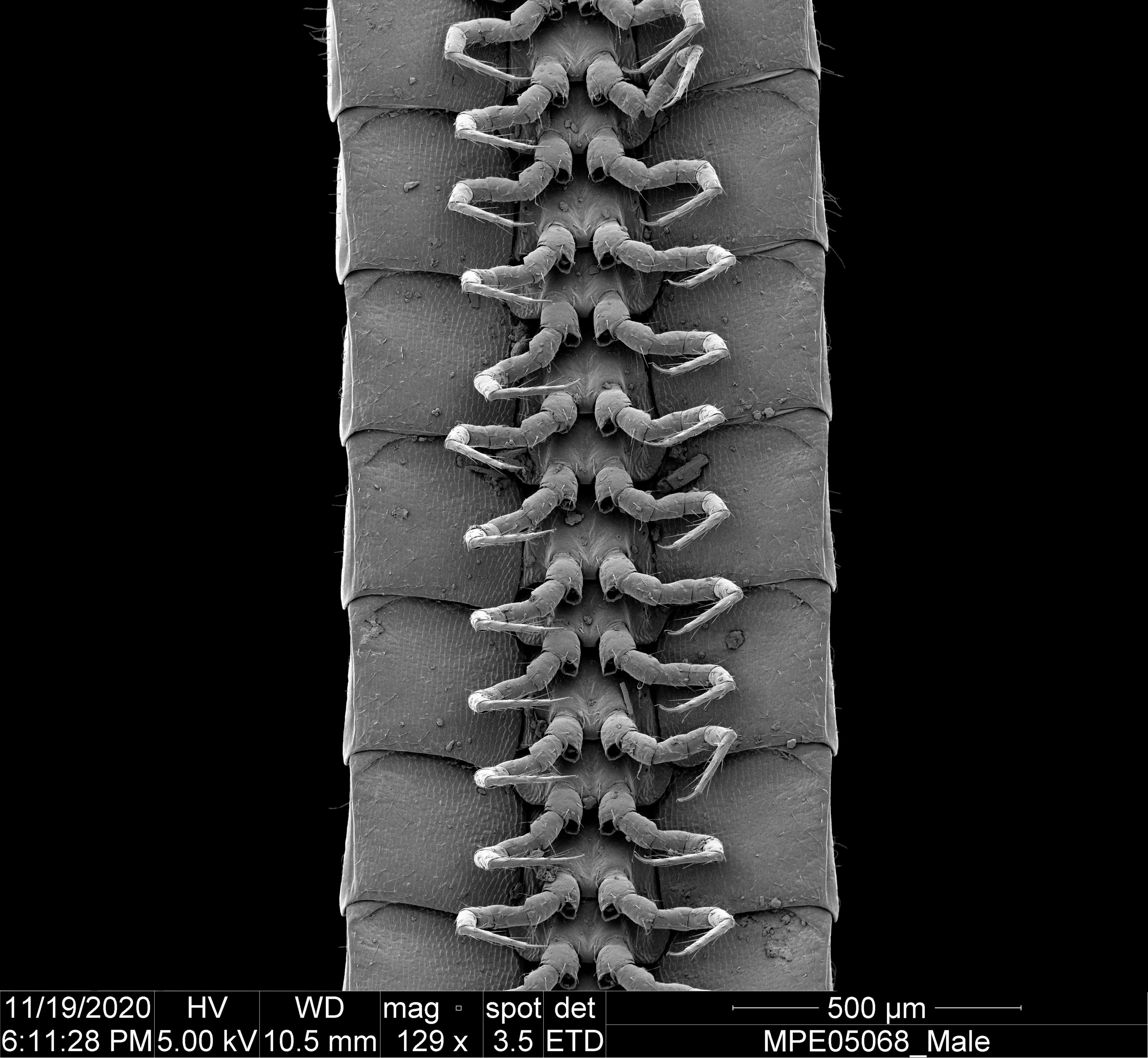 A ventral view of the legs of a male Eumillipes persephone.