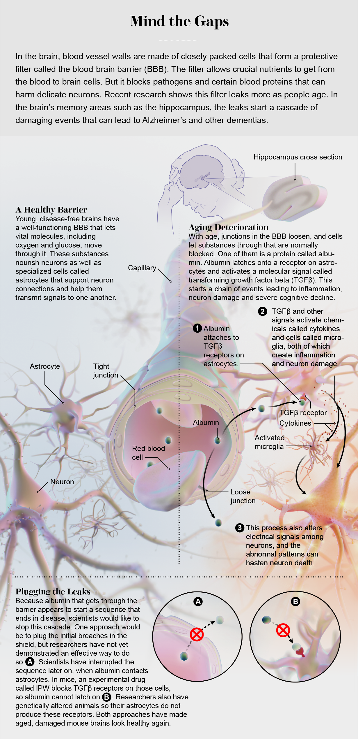 Graphic shows what happens in an aging brain when albumin crosses the blood-brain barrier and attaches to an astrocyte.