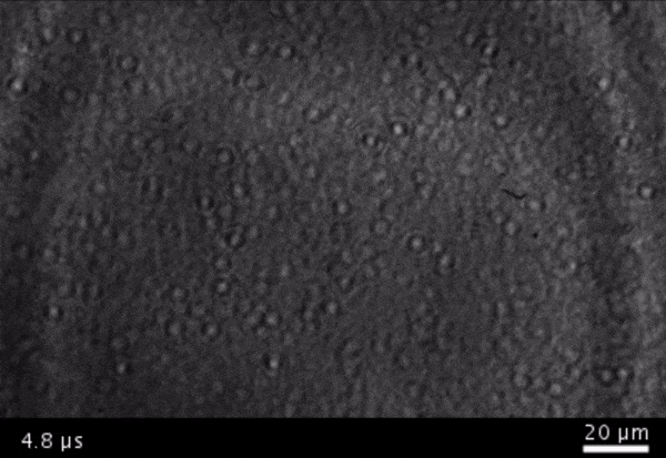 A gif loop of microbubbles forming and disappearing