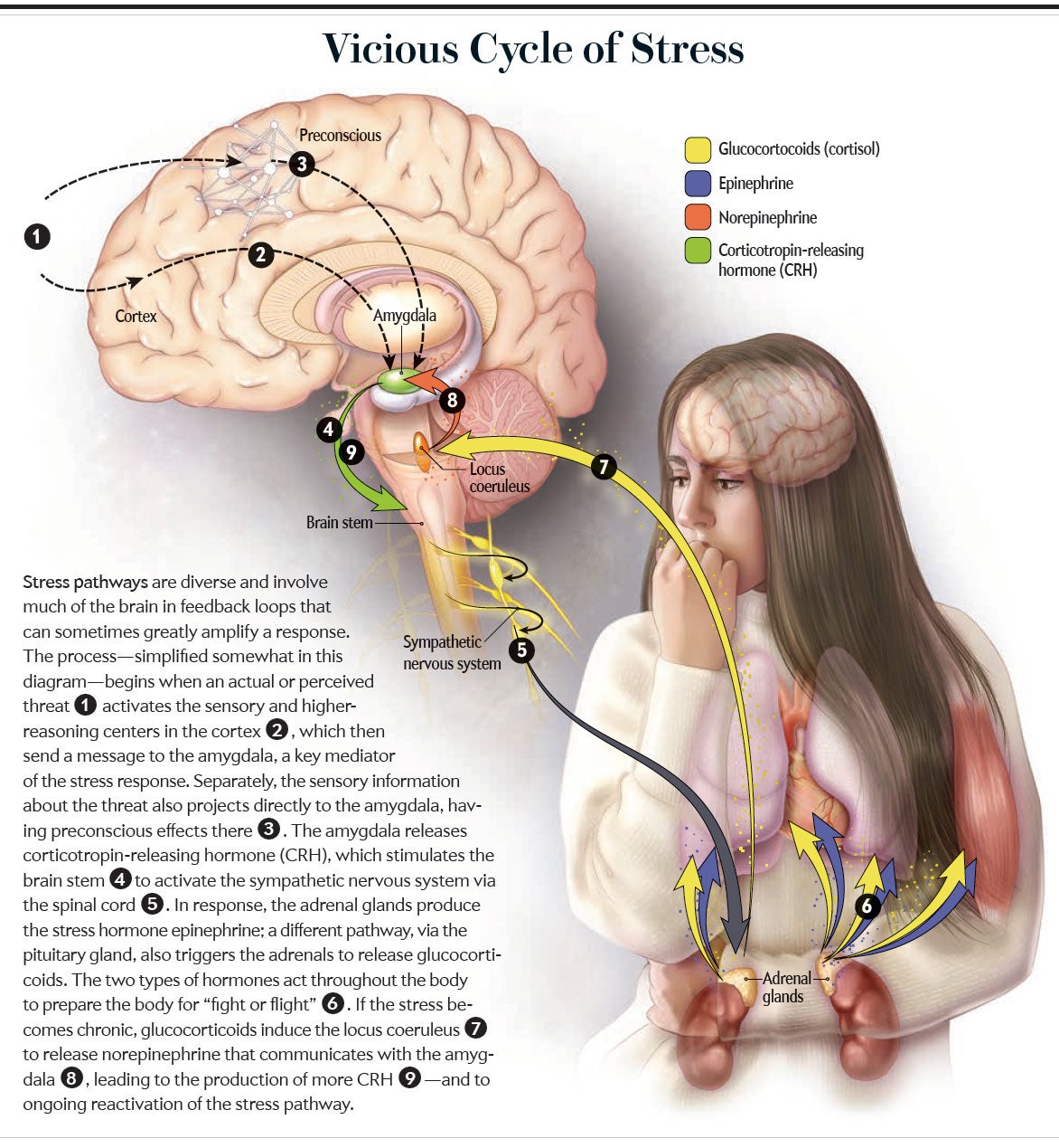 Cycle of stress graphic.