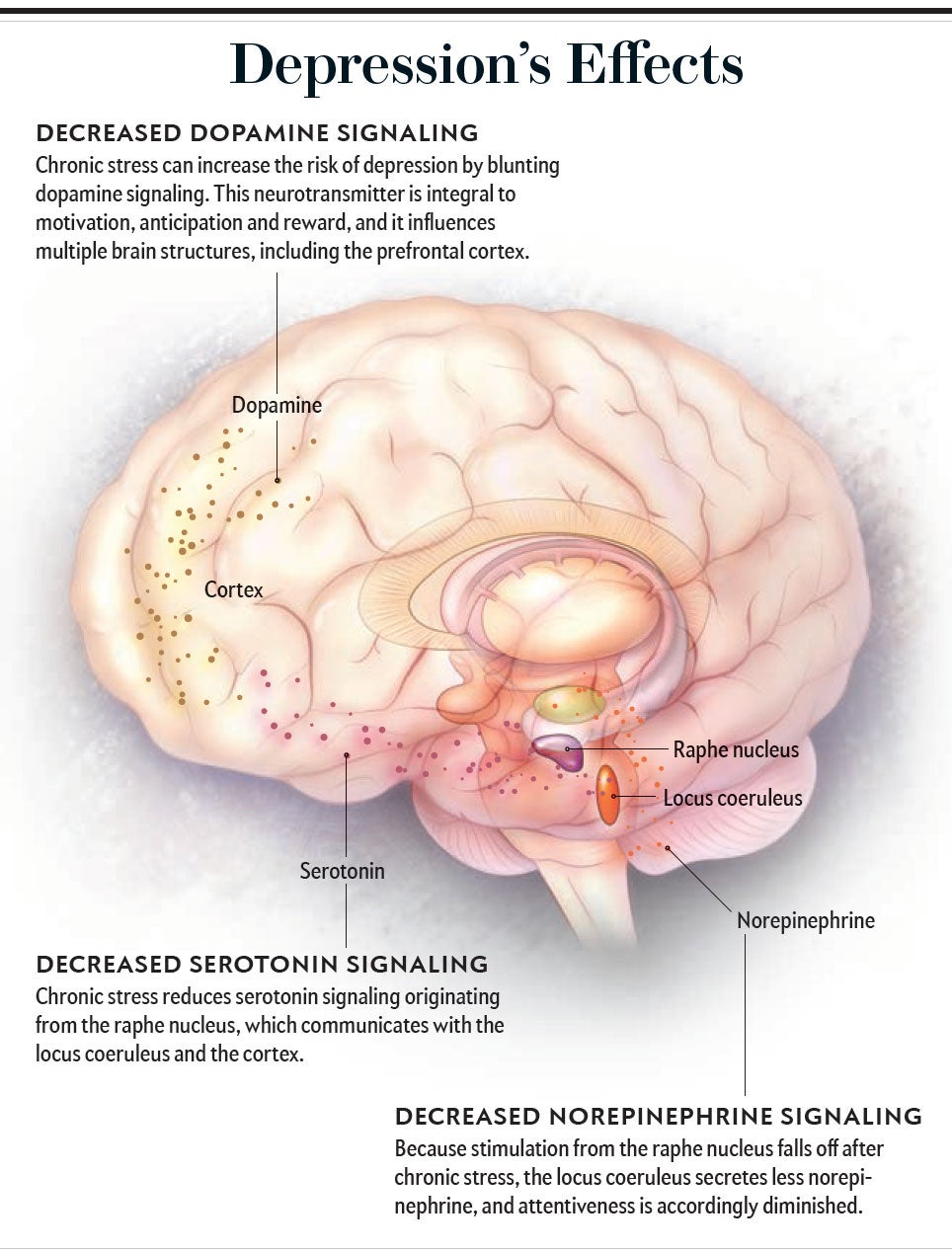 Depression effects graphic.