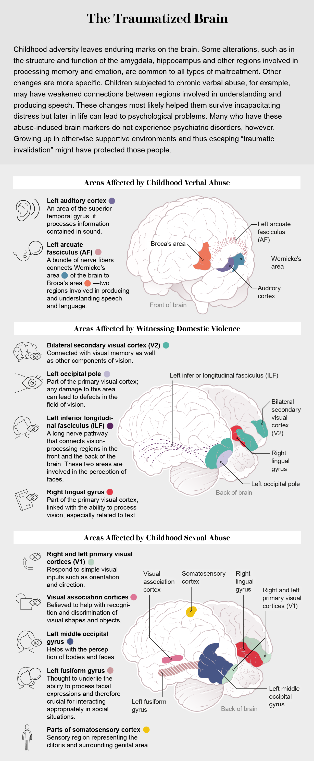 Graphic shows areas of the brain affected by sexual or verbal abuse or by the witness of domestic violence in childhood.
