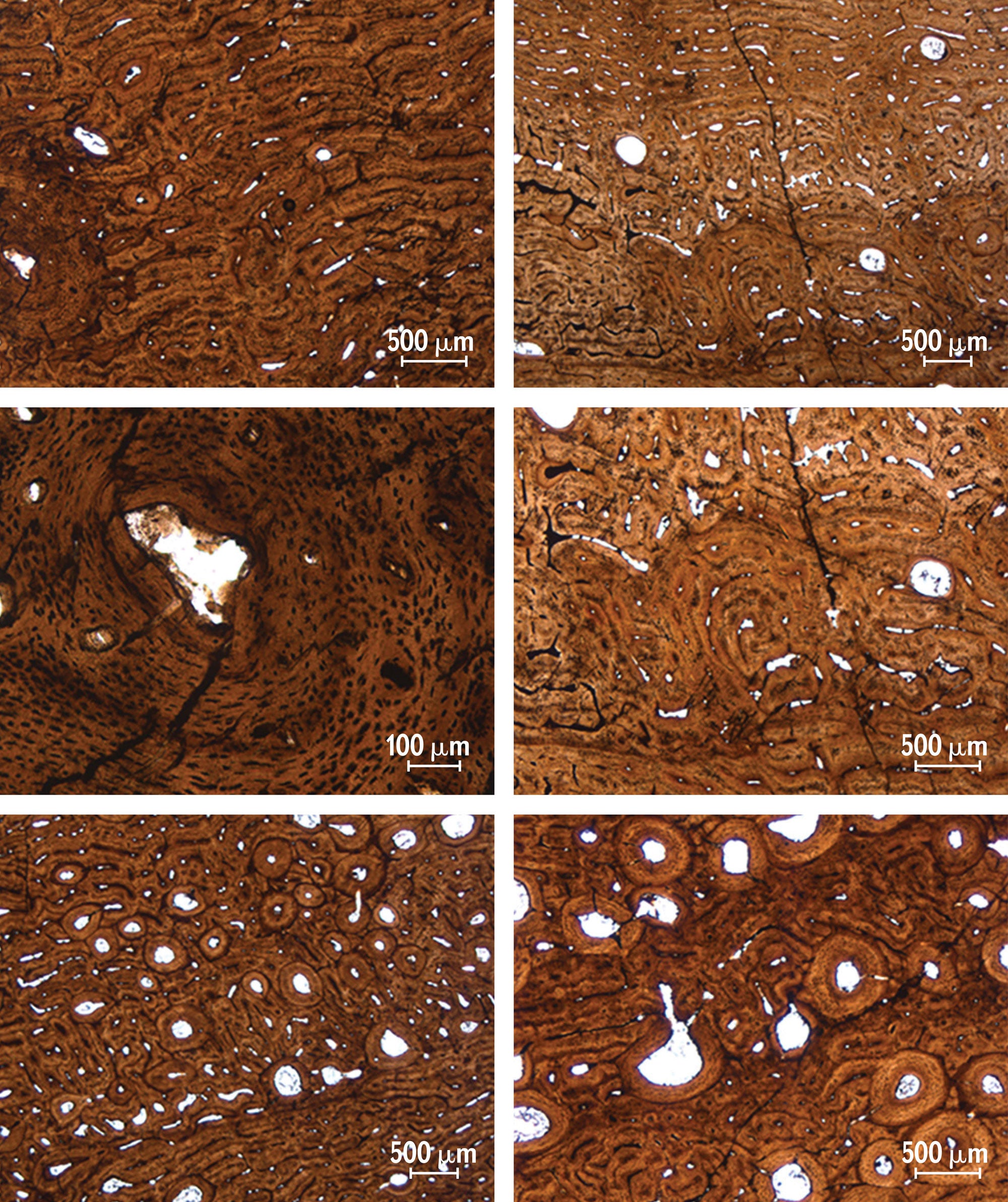 Microscopic views of structures in the femur of an Apatosaurus.