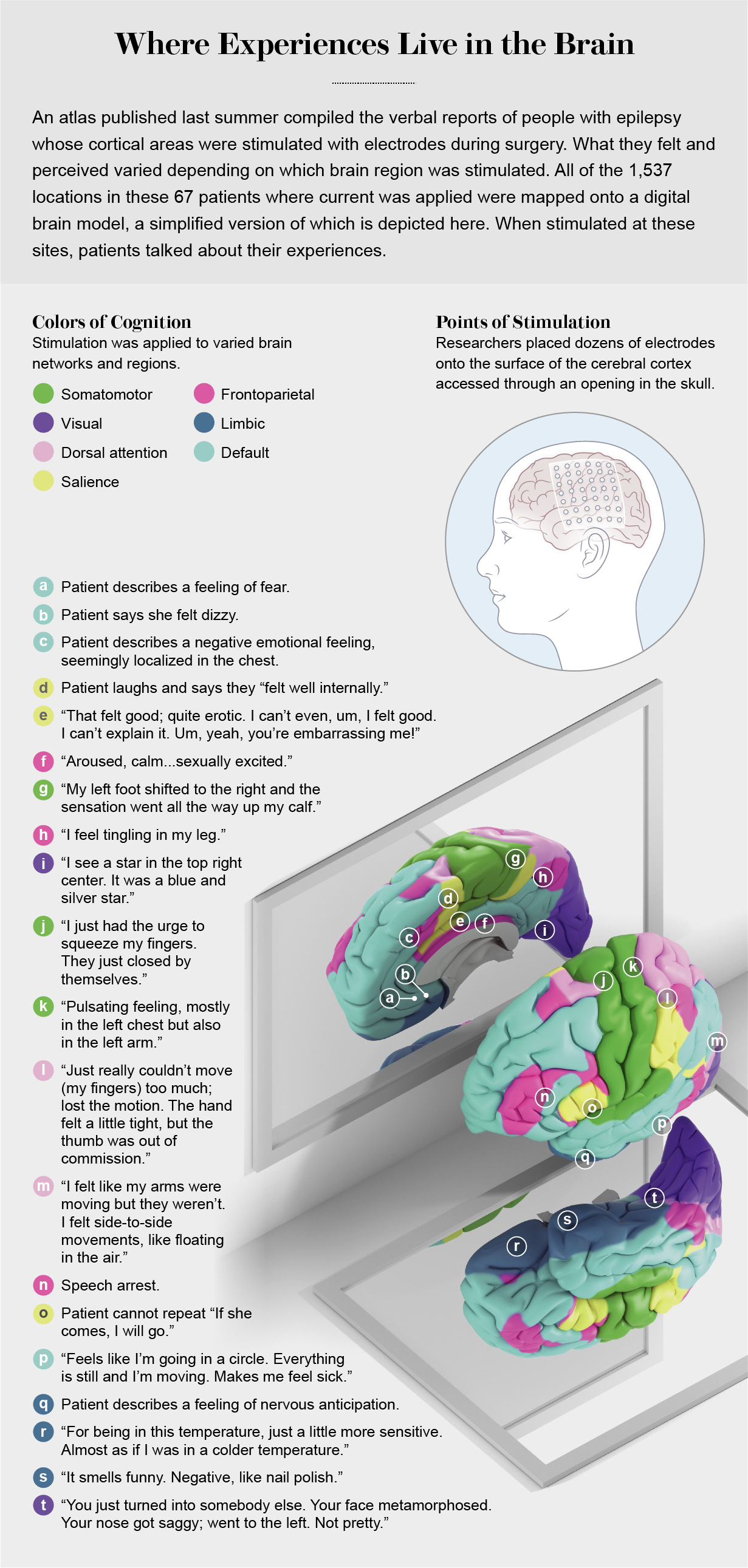 Graphic shows a brain hemisphere colored by region with descriptions of patients’ responses to stimulation of various points.