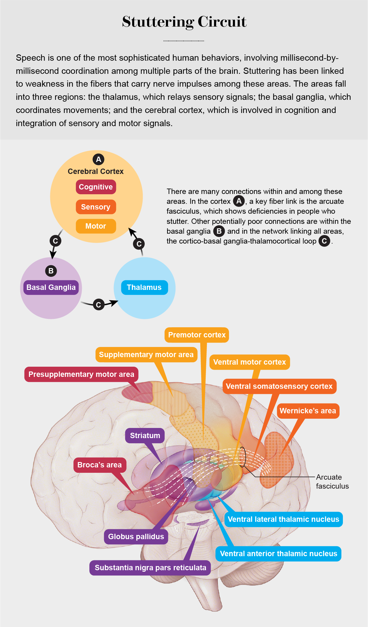 Brain diagram highlights the basal ganglia, thalamus, and key areas of the cerebral cortex involved stuttering.