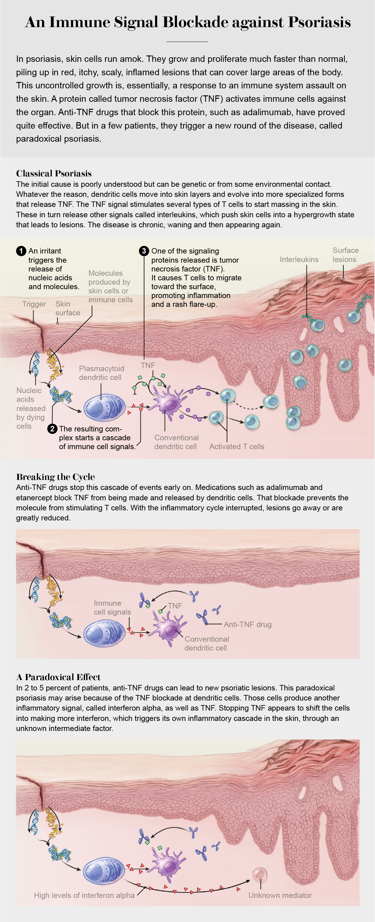 Graphic shows the role of tumor necrosis factor in psoriasis and how anti-TNF drugs can either prevent or exacerbate disease.
