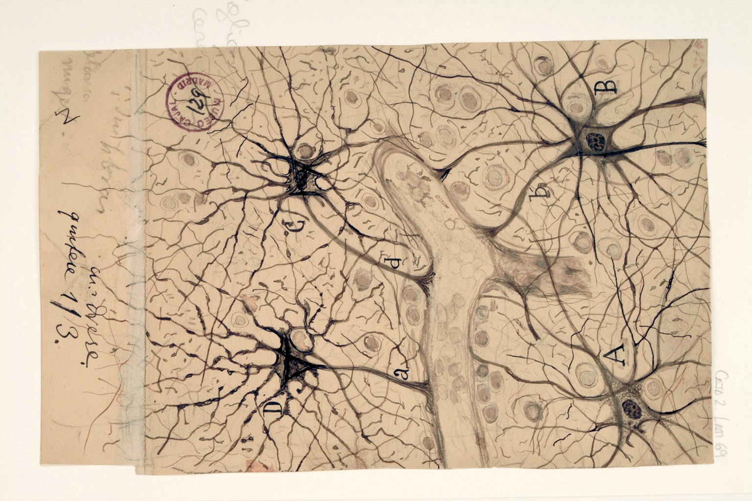 Astrocytes, support cells for neurons, surround a blood vessel.