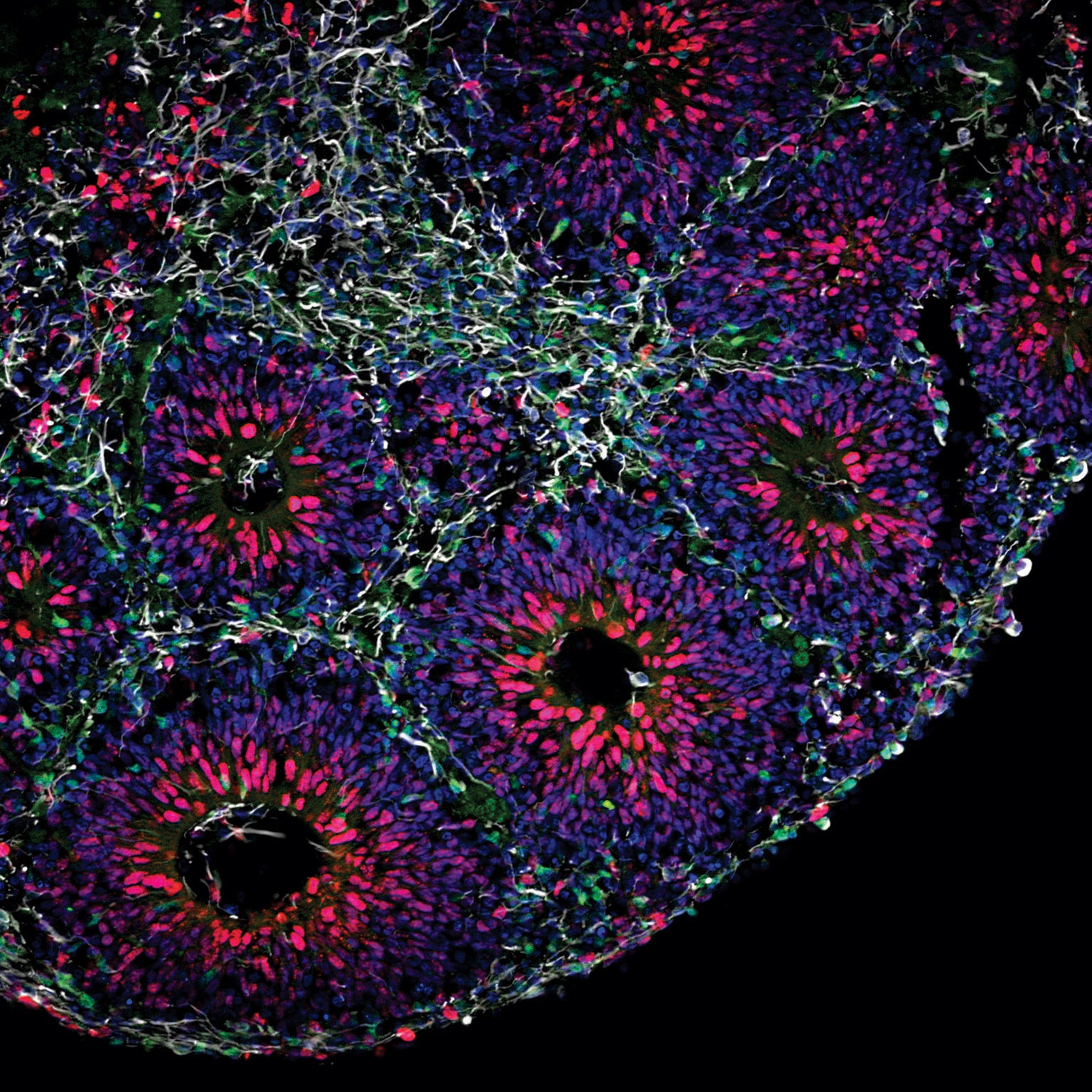 In developing human brain organoids, preneuronal cells (red) turn into neurons (green), which wire up into networks (white).