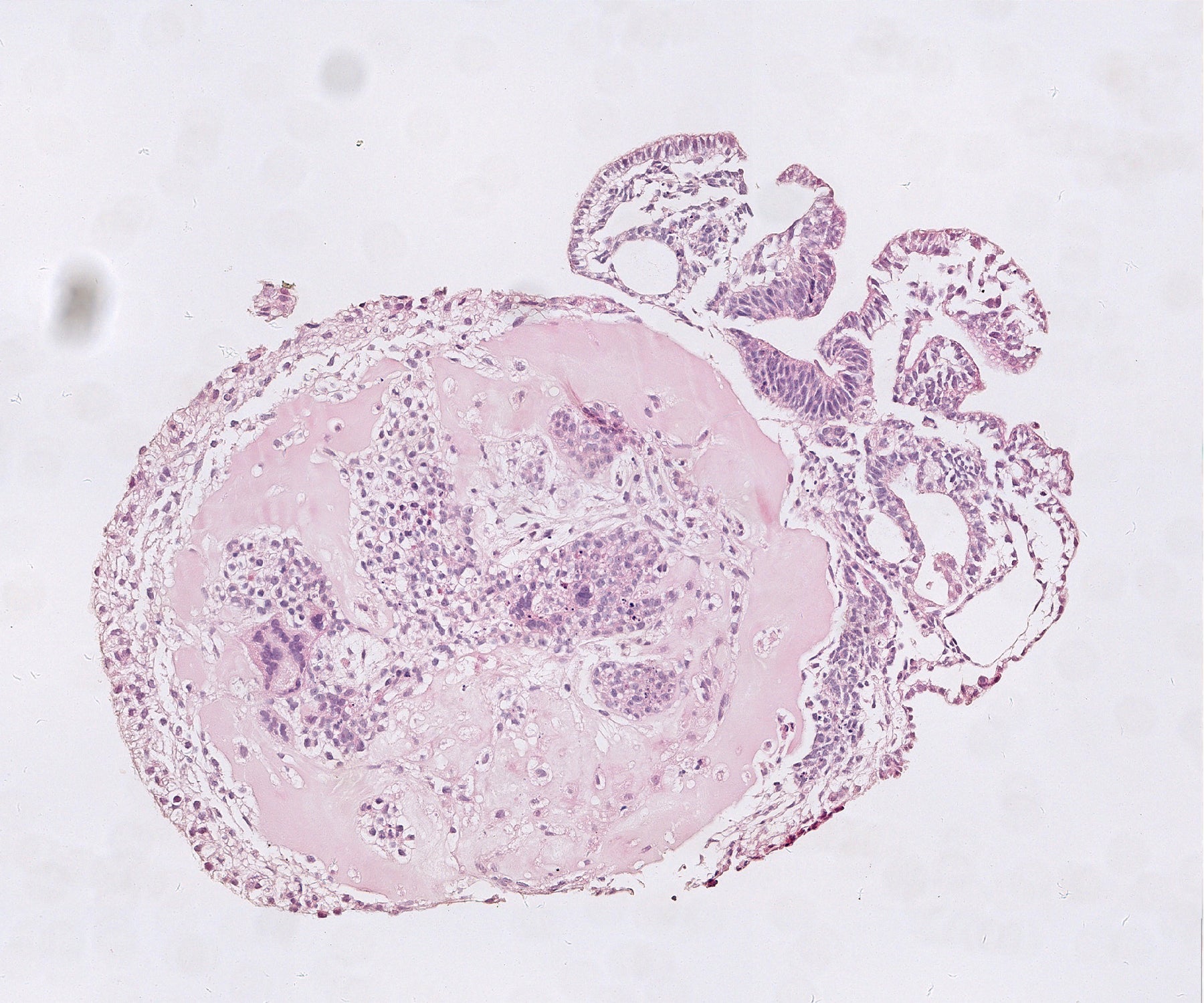 A 25-day-old monkey embryo stained with conventional dye (pink).