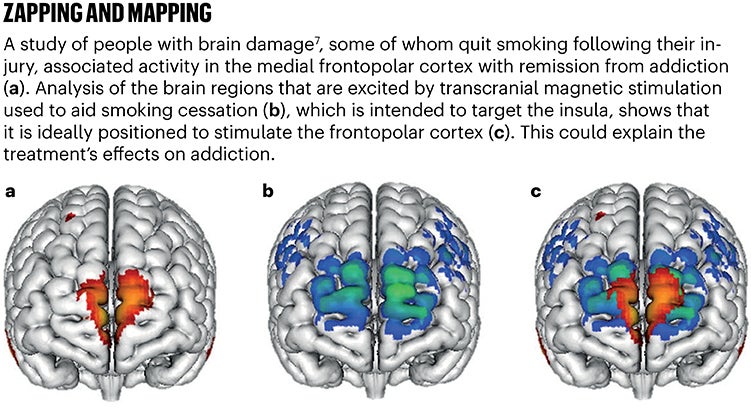 Zapping and mapping graphic of the brain.
