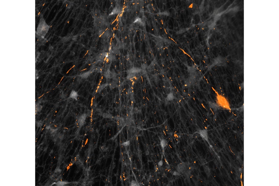 Image of "Erupting Neurons"