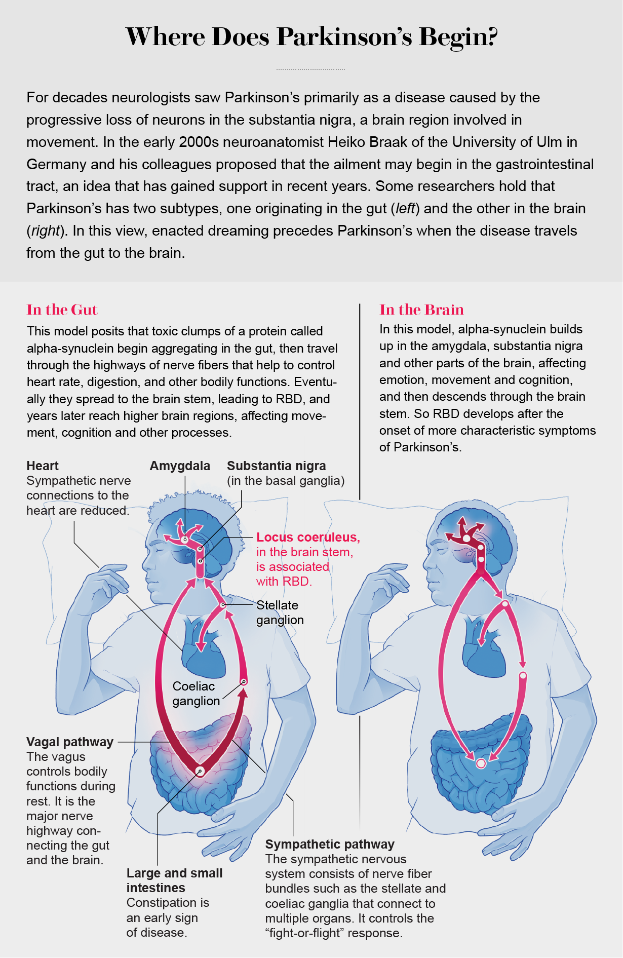 Graphic shows two pathways of Parkinson’s development: one where protein buildup starts in the gut and spreads to the brain and heart and another where it starts in the brain and spreads to the heart and gut.