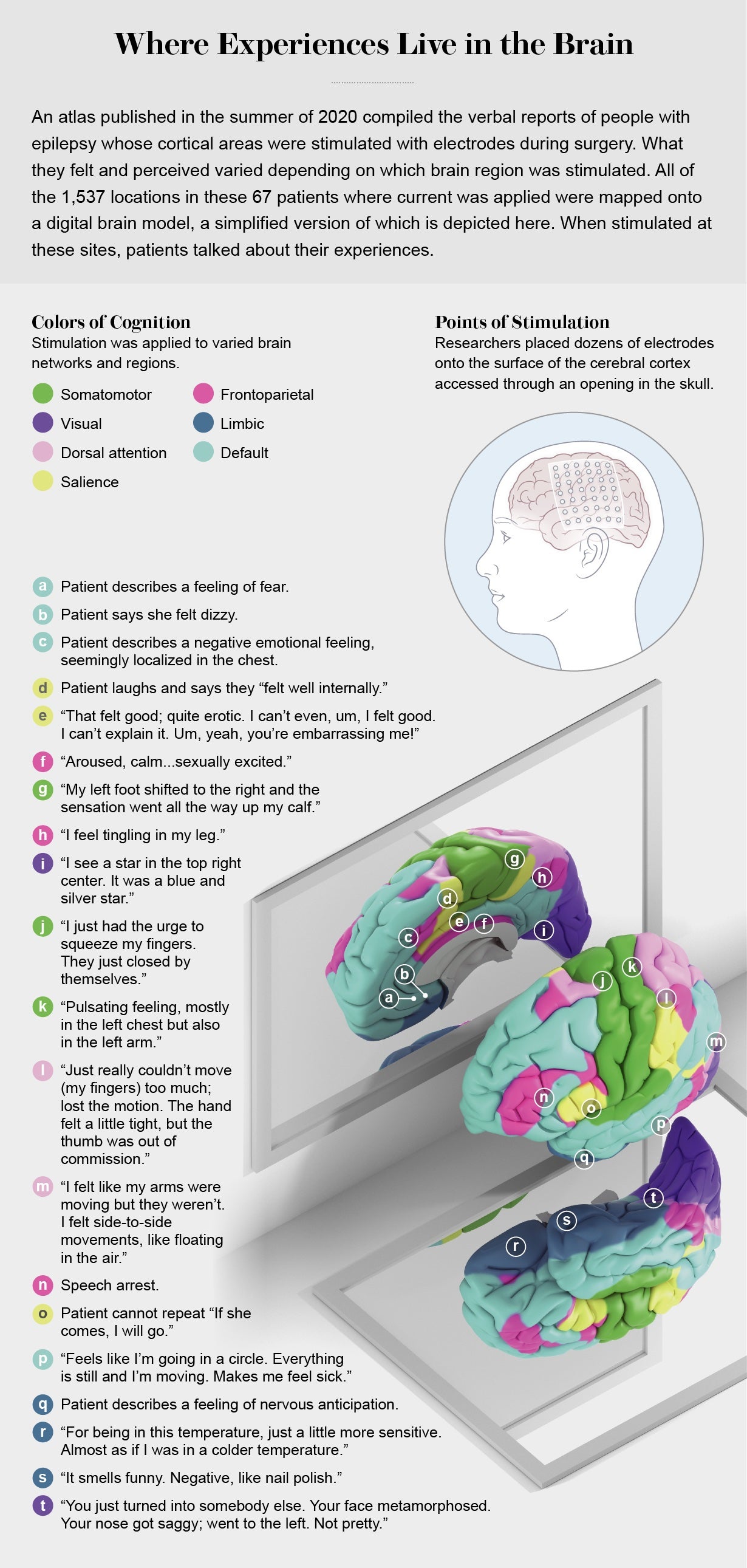 Graphic shows a brain hemisphere colored by region with descriptions of patients’ responses to stimulation of various points.